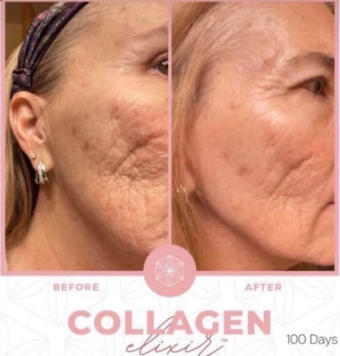 Isagenix collagen Elixir Before and After